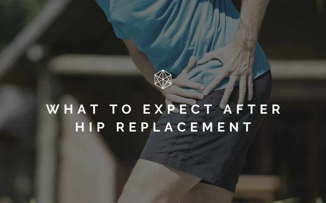 What to Expect After Hip Replacement